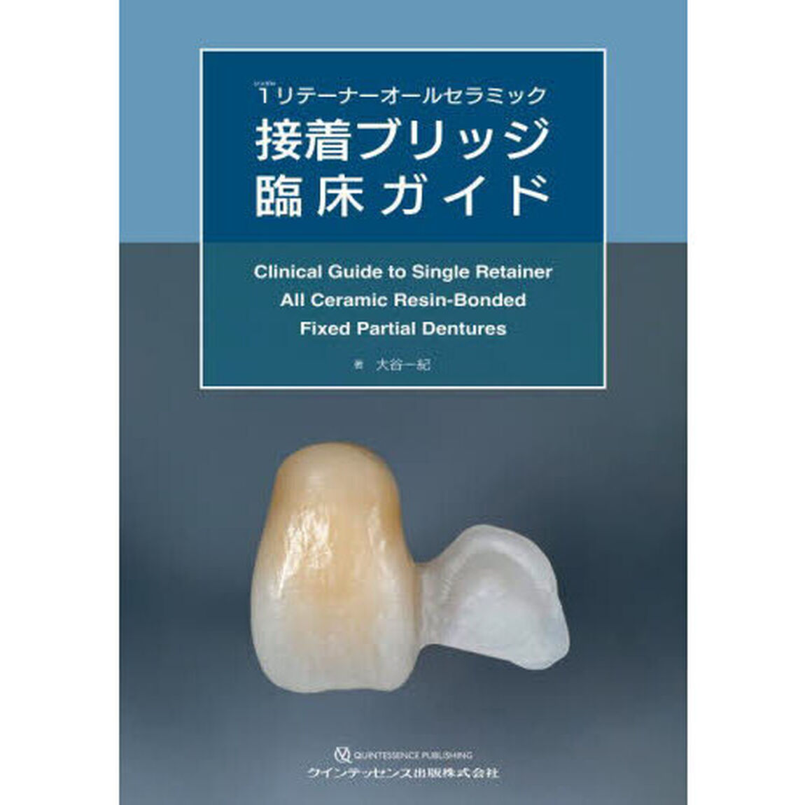 １（シングル）リテーナーオールセラミック接着ブリッジ臨床ガイド
