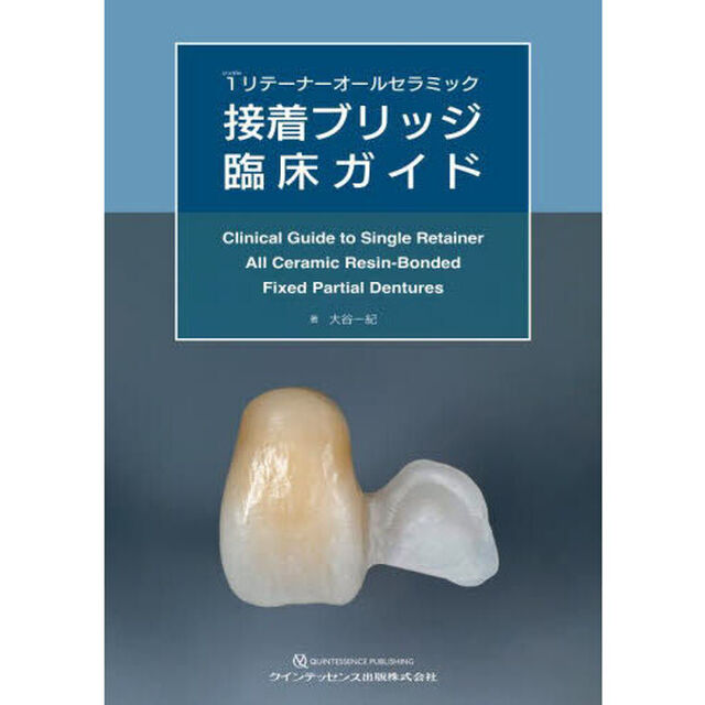 １（シングル）リテーナーオールセラミック接着ブリッジ臨床ガイド