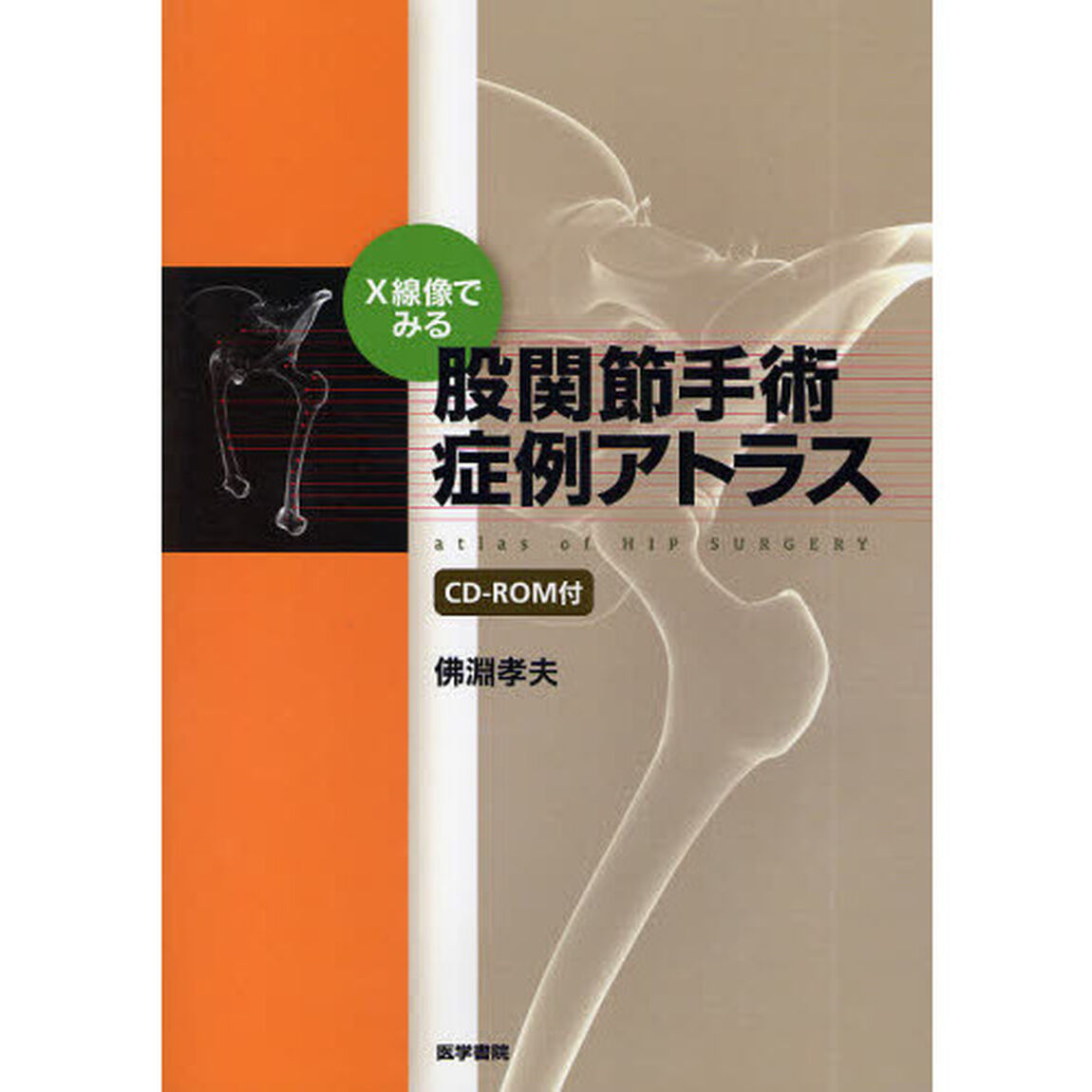 Ｘ線像でみる股関節手術症例アトラス