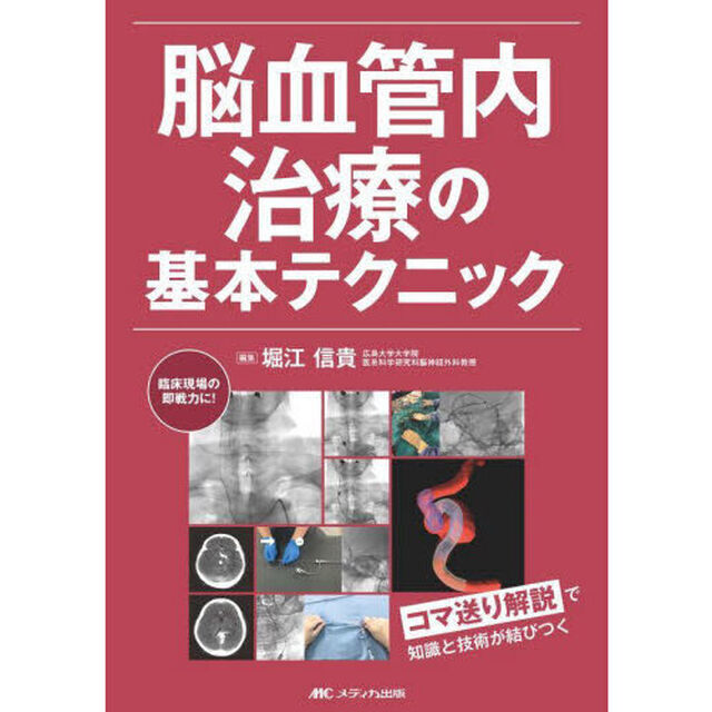 脳血管内治療の基本テクニック