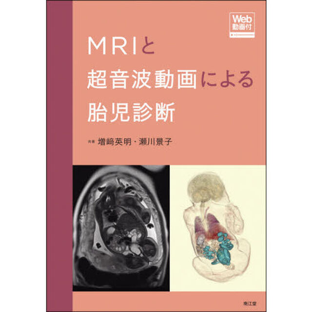 ＭＲＩと超音波動画による胎児診断　Ｗｅｂ動画付