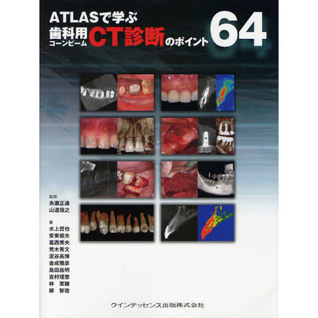 ＡＴＬＡＳで学ぶ歯科用コーンビームＣＴ診断のポイント６４
