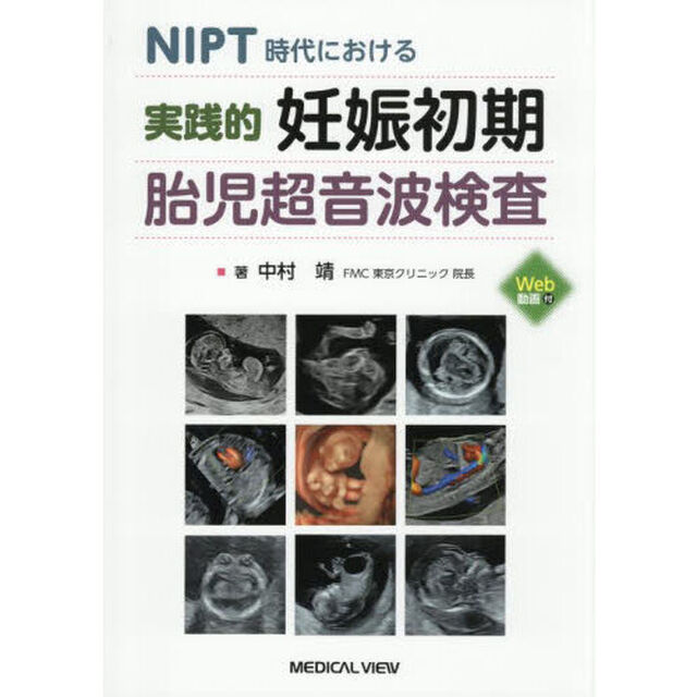 実践的妊娠初期胎児超音波検査　ＮＩＰＴ時代における