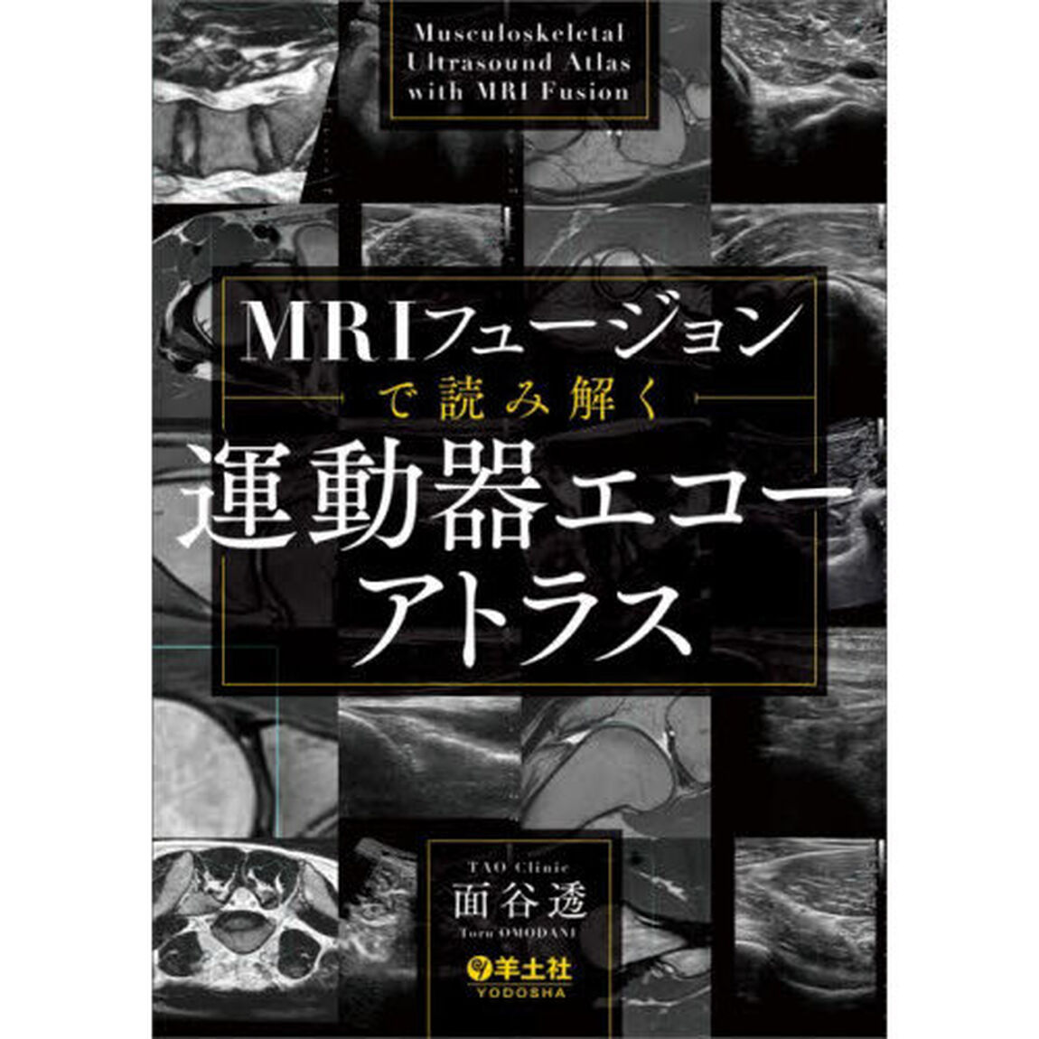 ＭＲＩフュージョンで読み解く運動器エコーアトラス