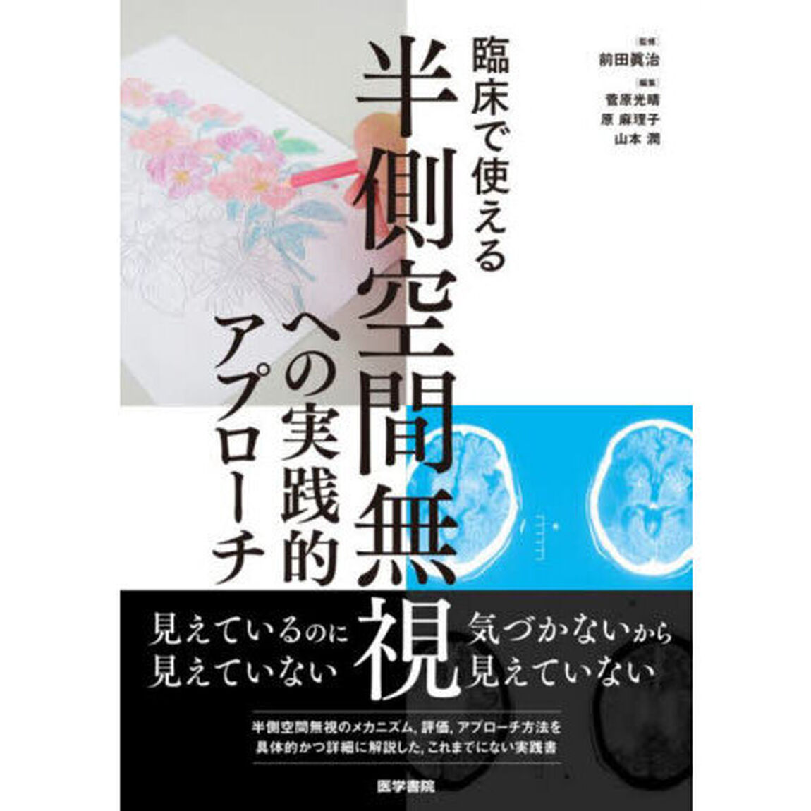 臨床で使える半側空間無視への実践的アプローチ