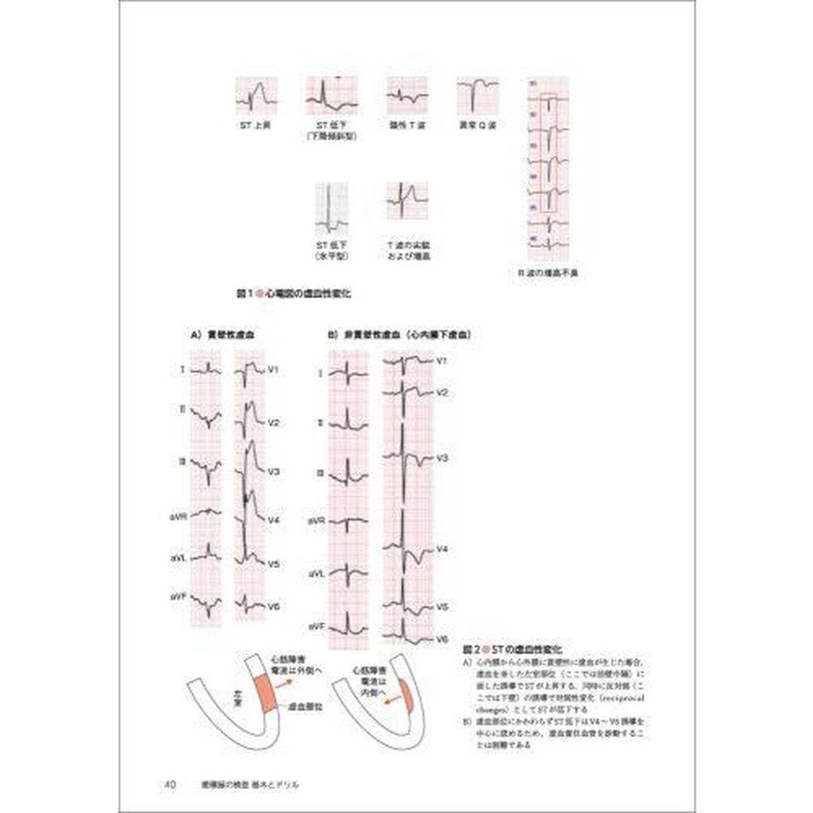 循環器の検査基本とドリル　心電図・心エコーなどの適切な検査の選び方・考え方
