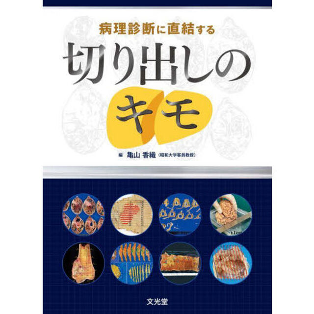 病理診断に直結する切り出しのキモ
