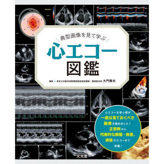 典型画像を見て学ぶ心エコー図鑑
