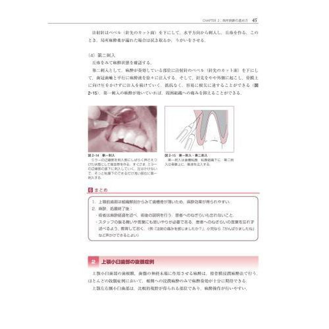 歯科局所麻酔の基本と勘所