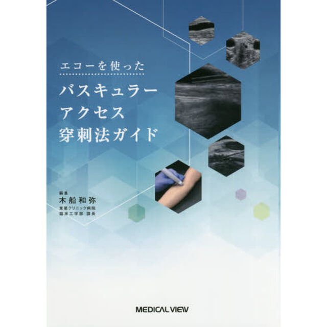 エコーを使ったバスキュラーアクセス穿刺法ガイド