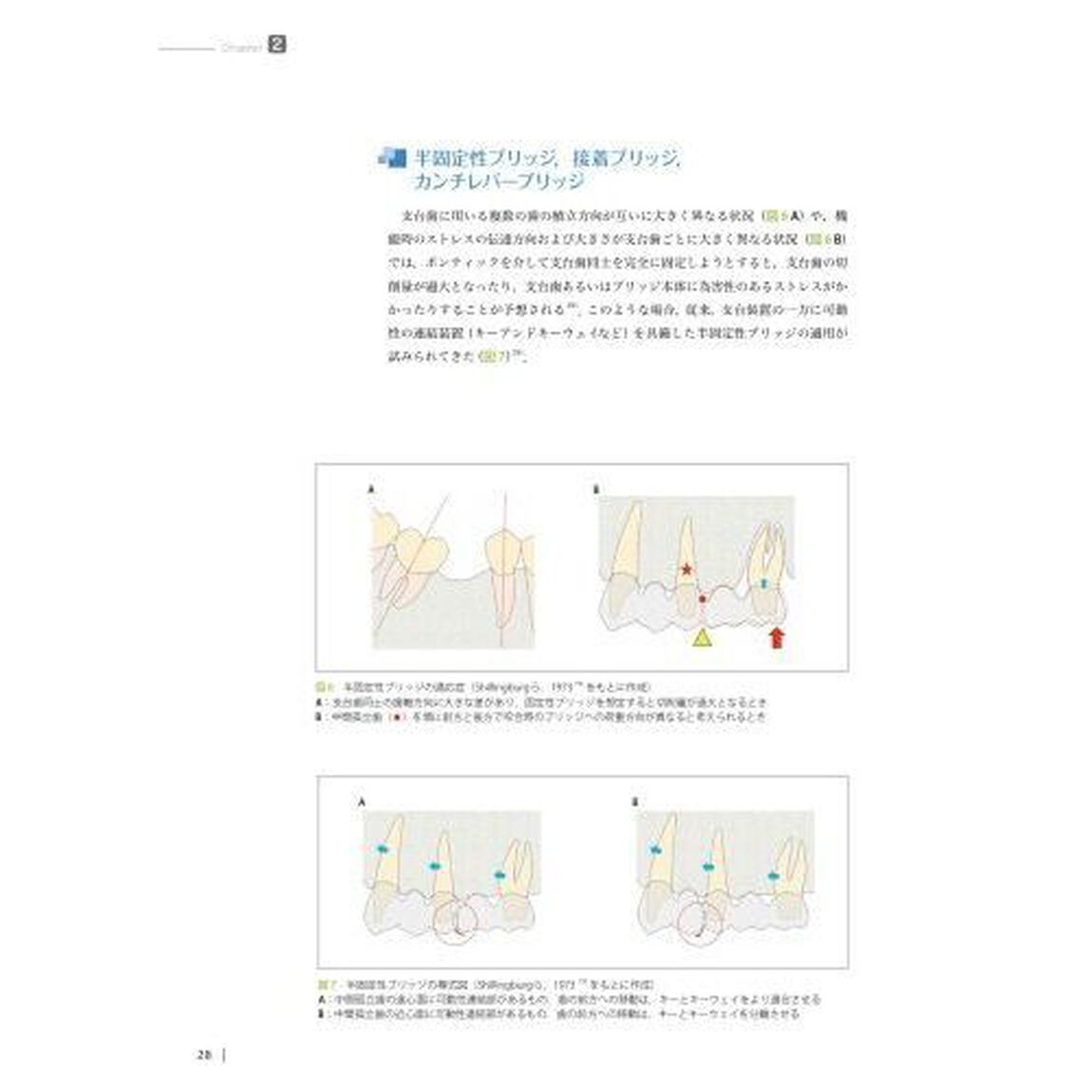 ブリッジ・部分床義歯の支台歯選択