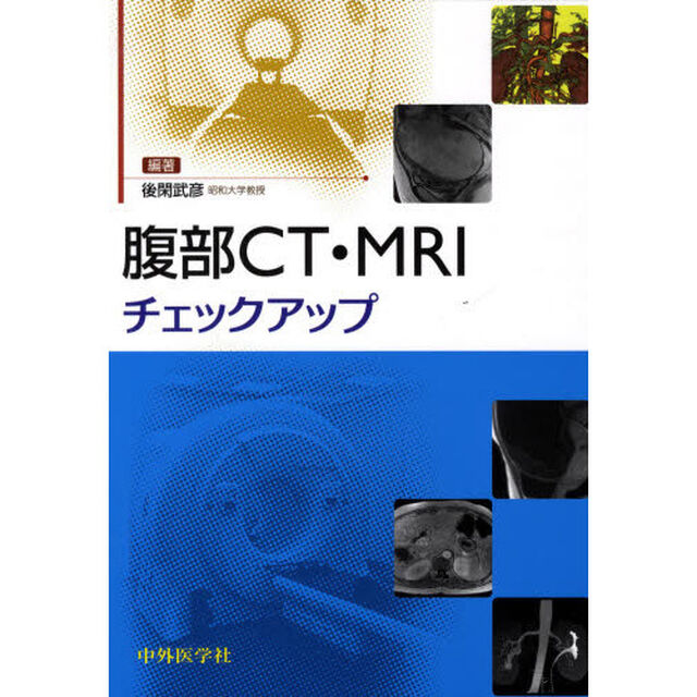 腹部ＣＴ・ＭＲＩチェックアップ