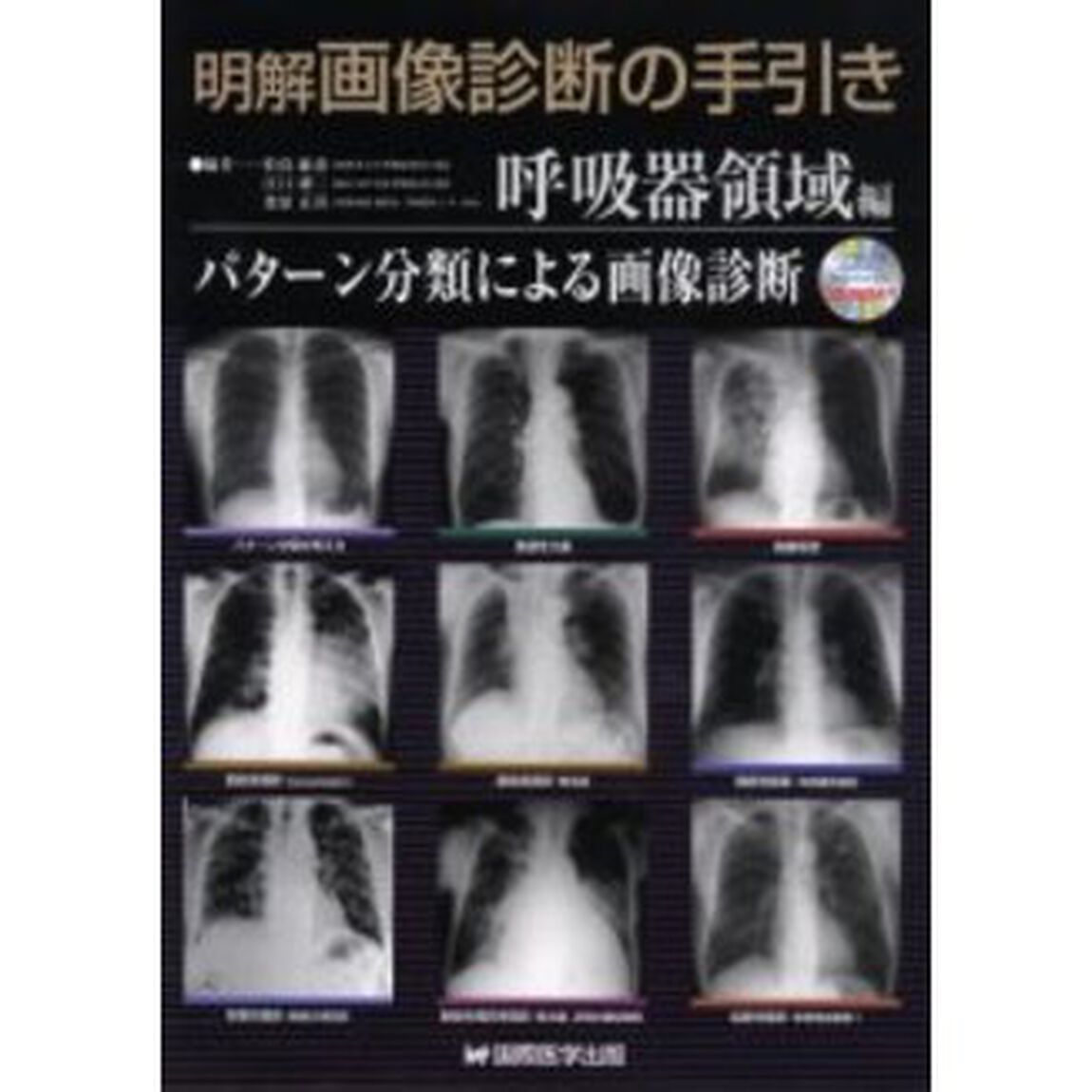 明解画像診断の手引き　呼吸器領域編「パターン分類による画像診断」