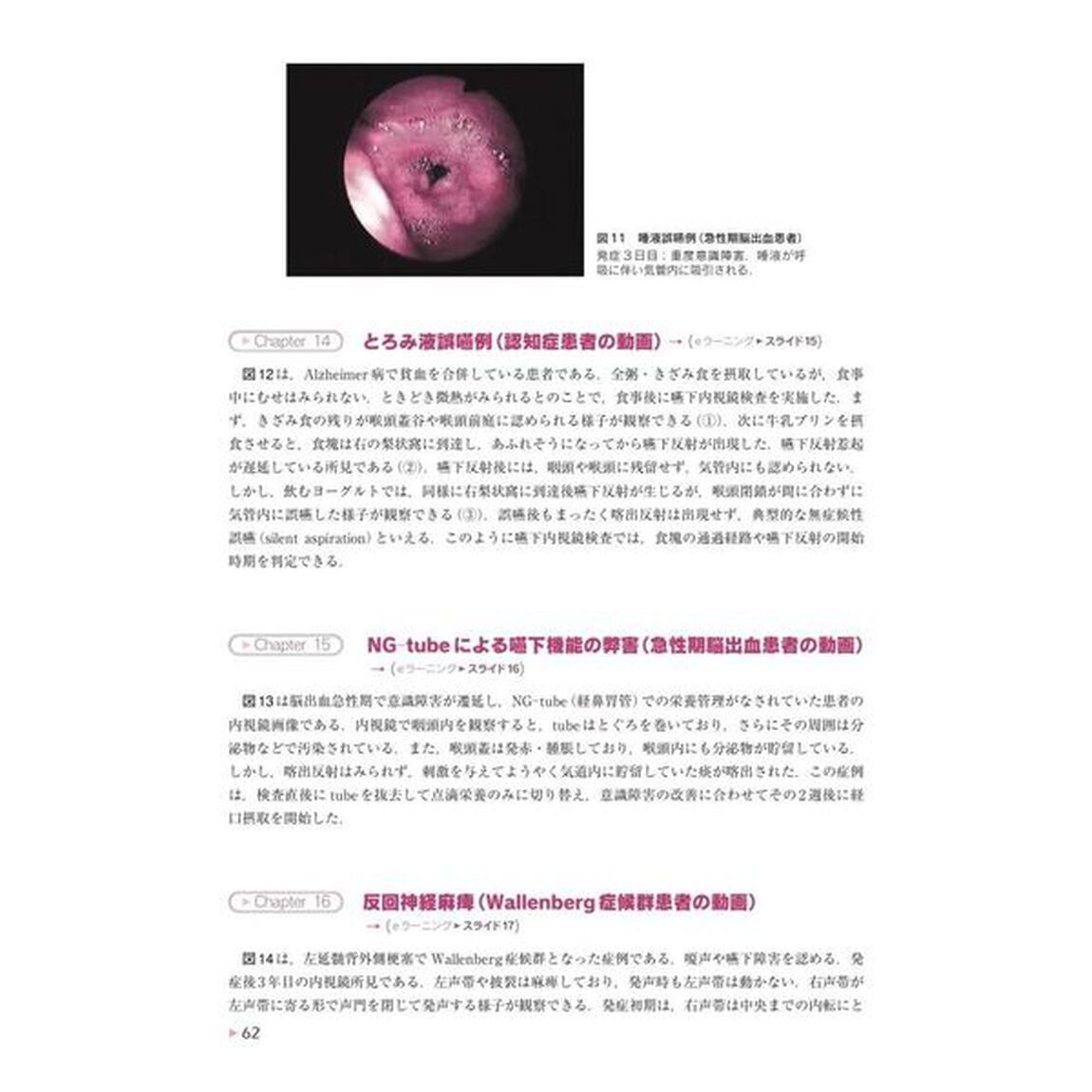第３分野摂食嚥下障害の評価　日本摂食嚥下リハビリテーション学会ｅラーニング対応「Ｖｅｒ．４」