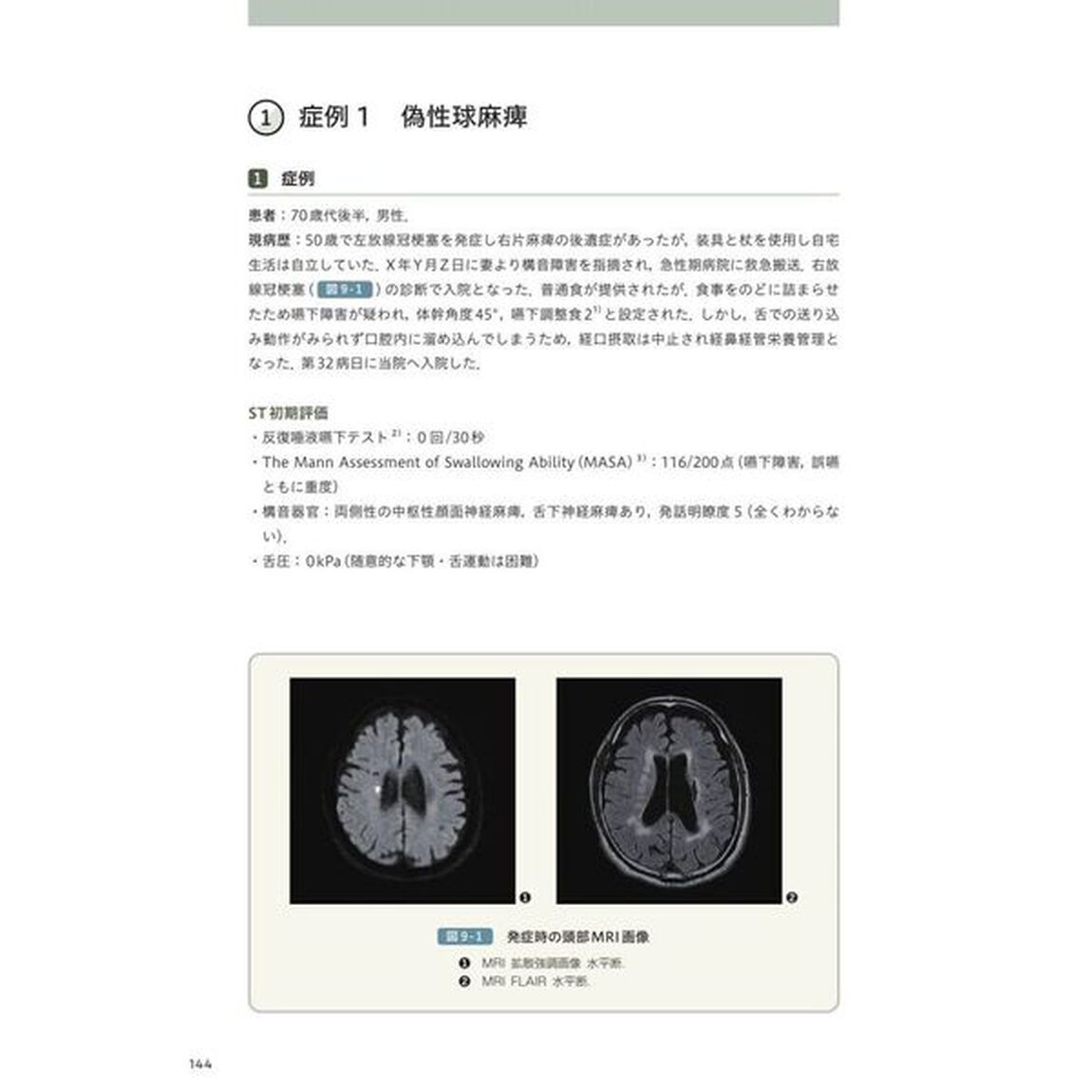 目でみる嚥下障害