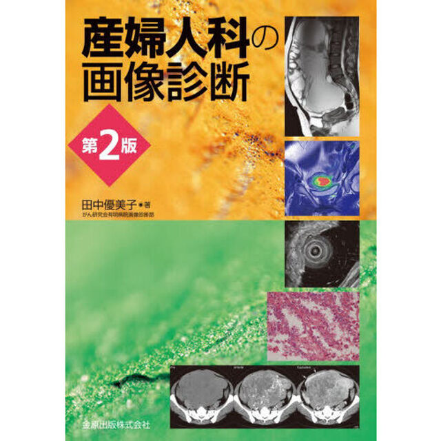 産婦人科の画像診断「第２版」