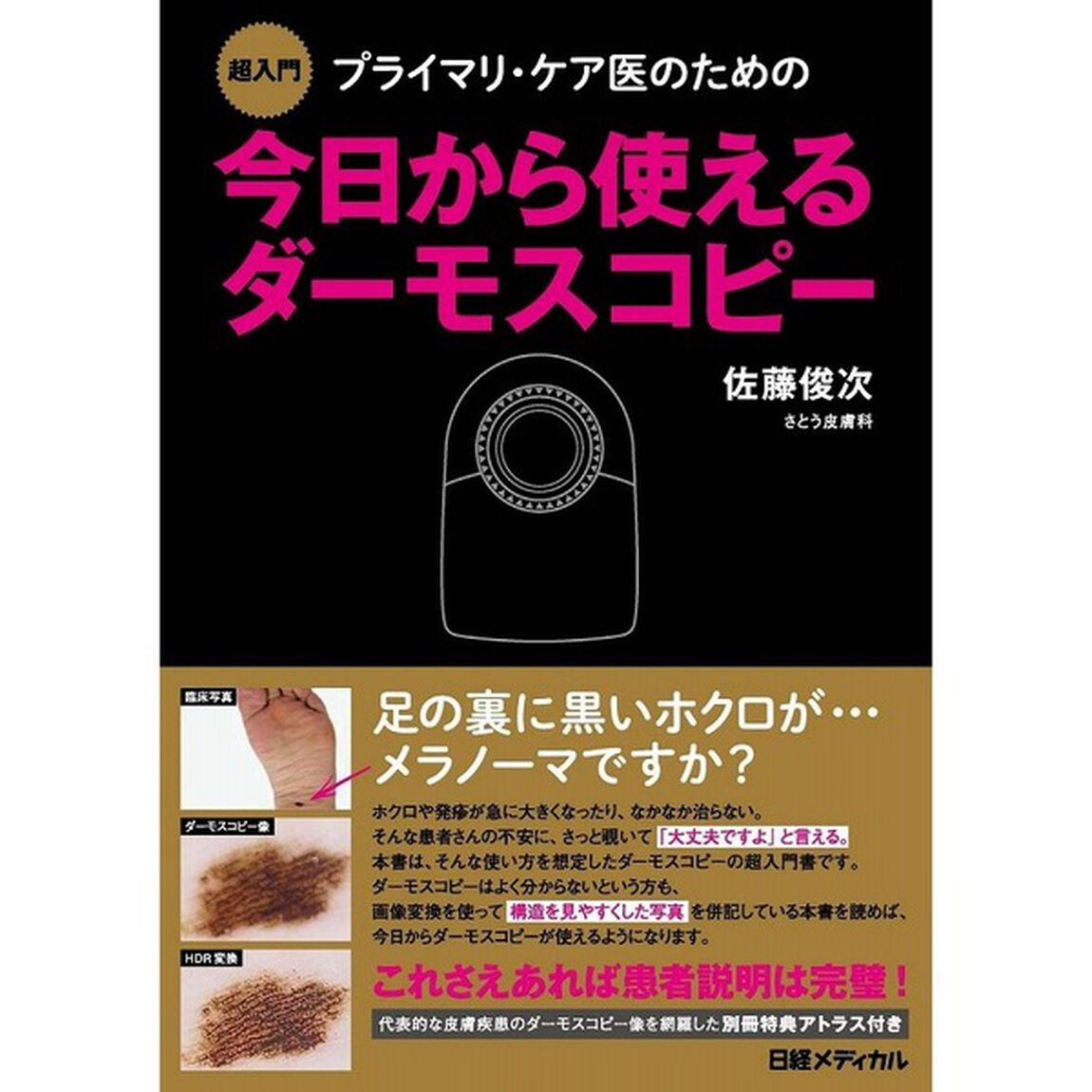 超入門 プライマリ・ケア医のための今日から使えるダーモスコピー