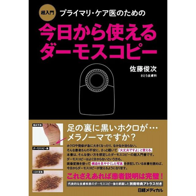 超入門 プライマリ・ケア医のための今日から使えるダーモスコピー
