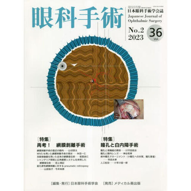 眼科手術　日本眼科手術学会誌　Ｖｏｌ．３６Ｎｏ．２（２０２３）「特集再考！網膜剥離手術／瞳孔と白内障手術」