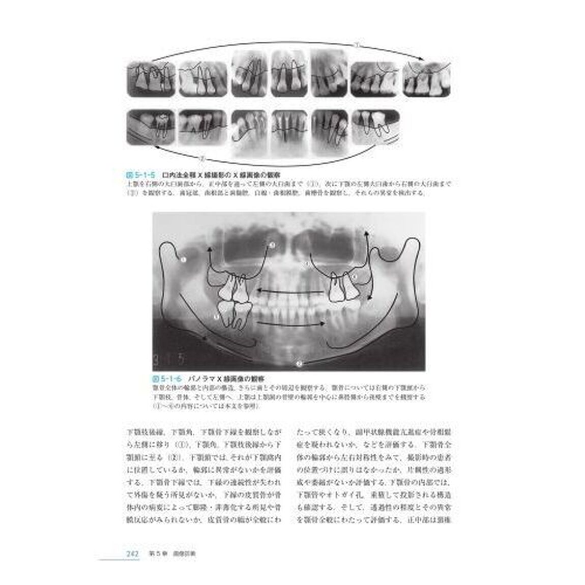 歯科放射線学「第７版」