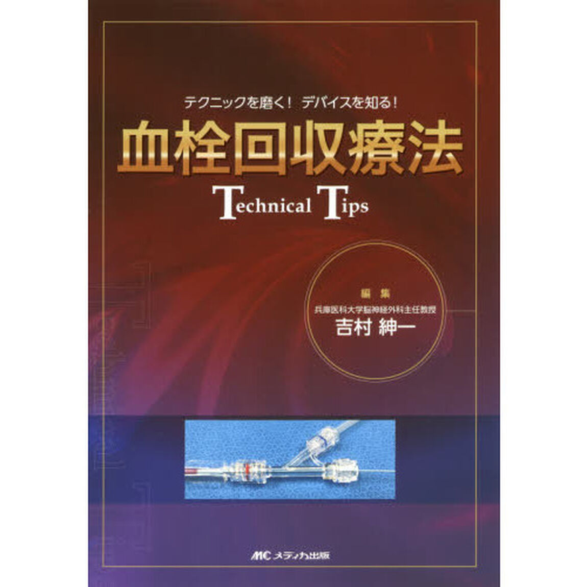 血栓回収療法Ｔｅｃｈｎｉｃａｌ　Ｔｉｐｓ　テクニックを磨く！デバイスを知る！