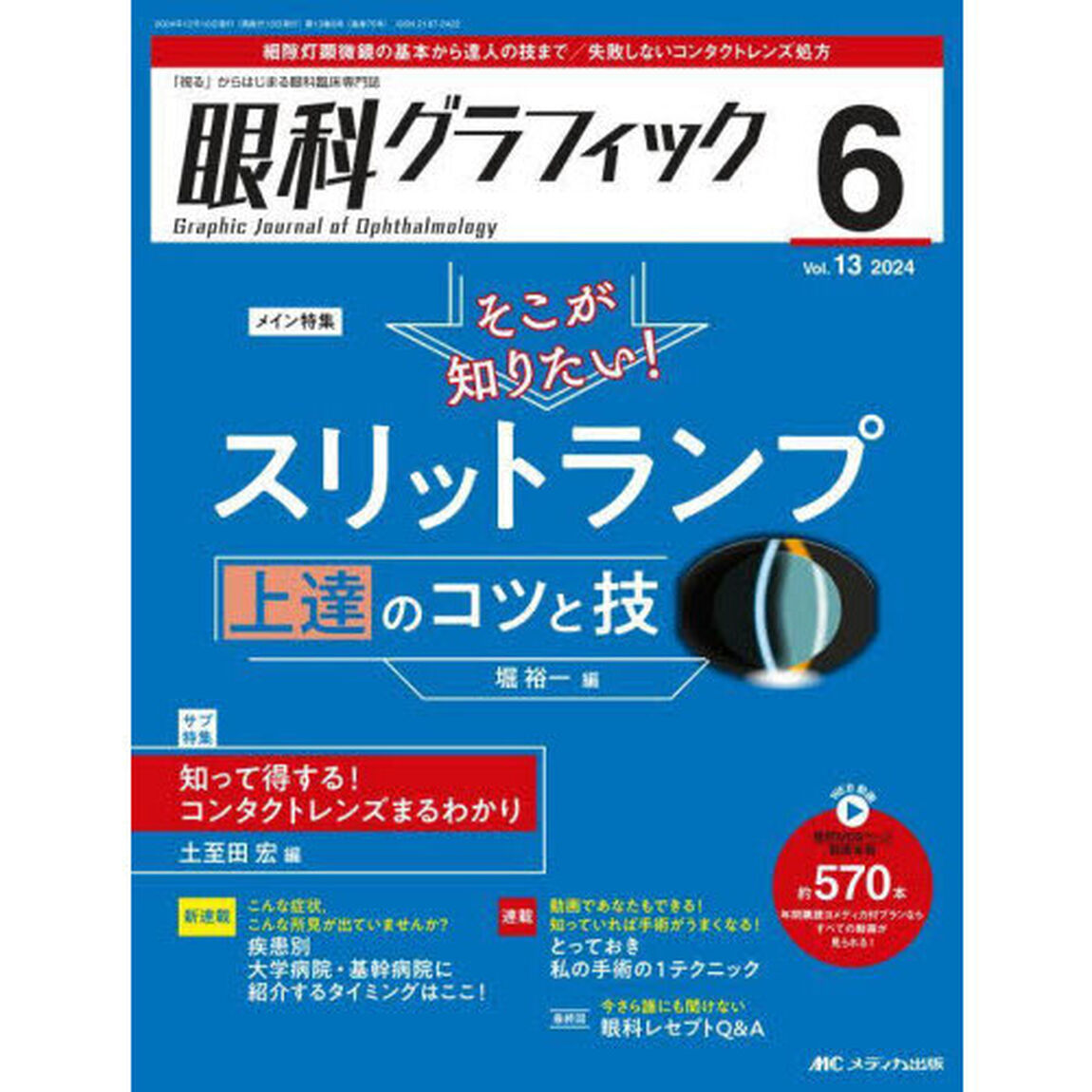眼科グラフィック　「視る」からはじまる眼科臨床専門誌　第１３巻６号（２０２４）「そこが知りたい！スリットランプ上達のコツと技」