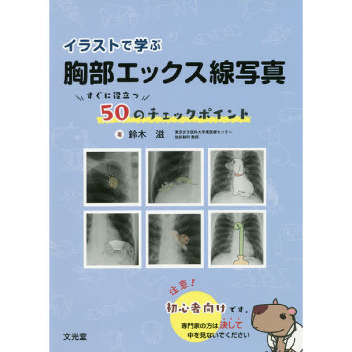 イラストで学ぶ胸部エックス線写真　すぐに役立つ５０のチェックポイント
