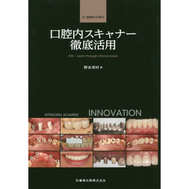 ３１症例から学ぶ口腔内スキャナー徹底活用