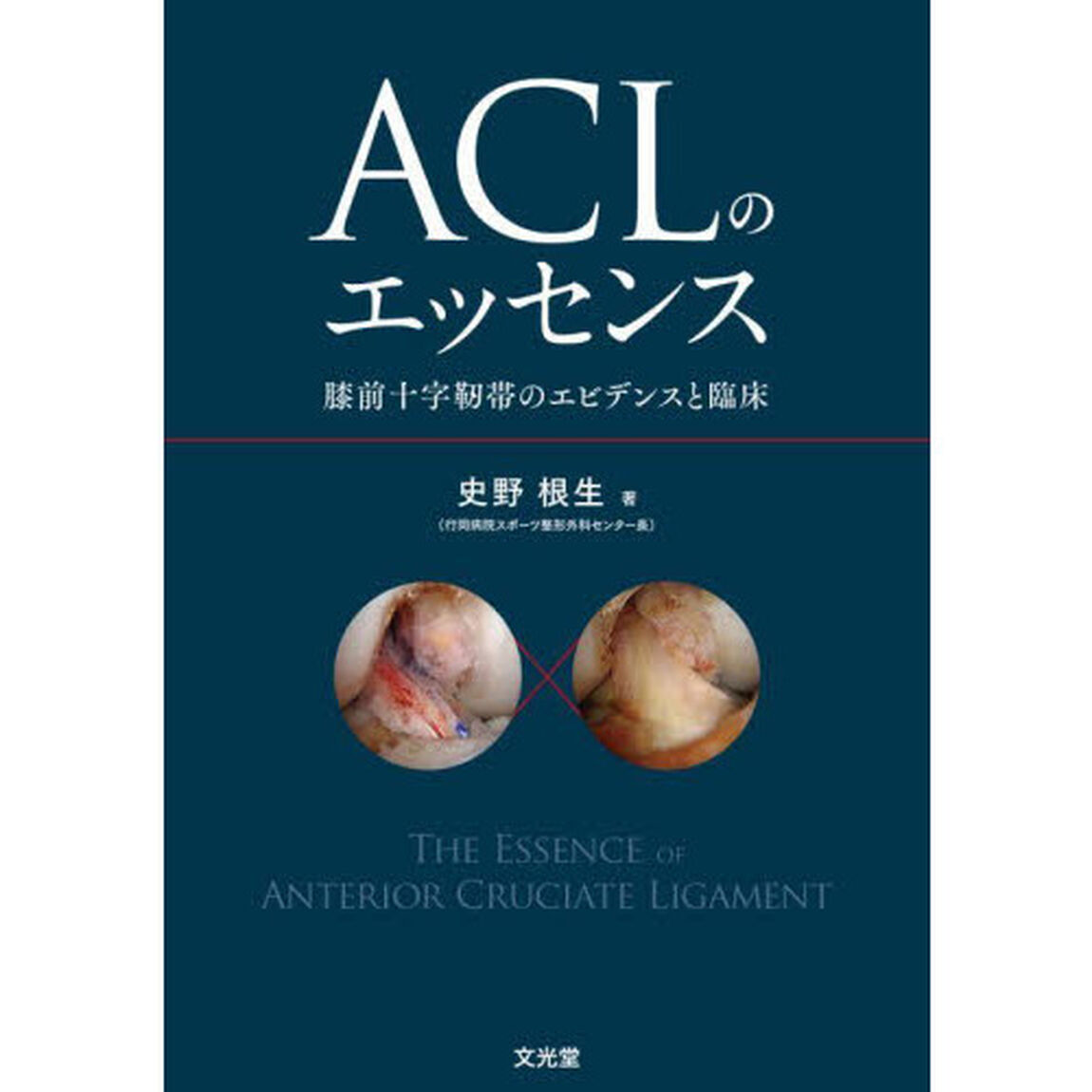 ＡＣＬのエッセンス　膝前十字靭帯のエビデンスと臨床