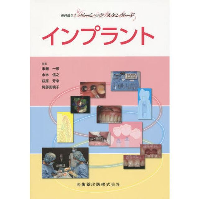 インプラント