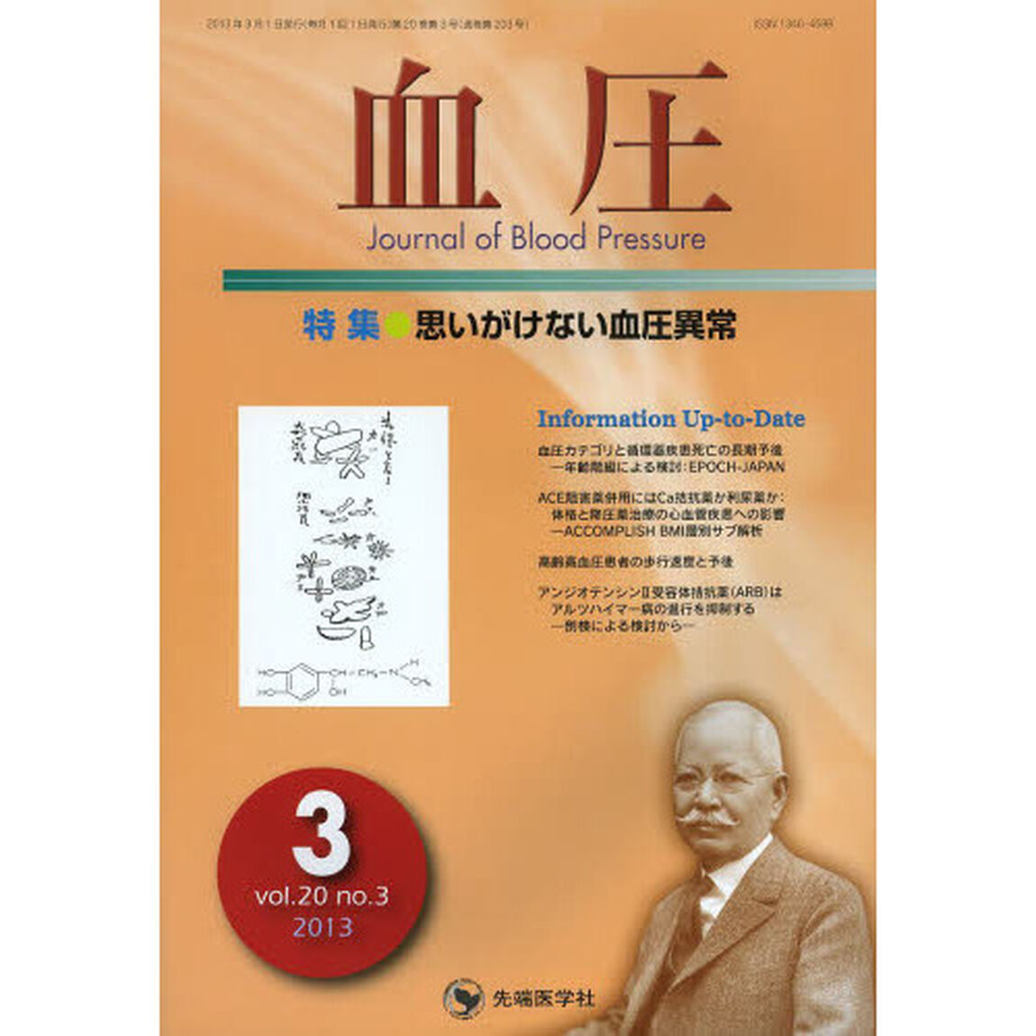 血圧　ｖｏｌ．２０ｎｏ．３（２０１３－３）「特集・思いがけない血圧異常」