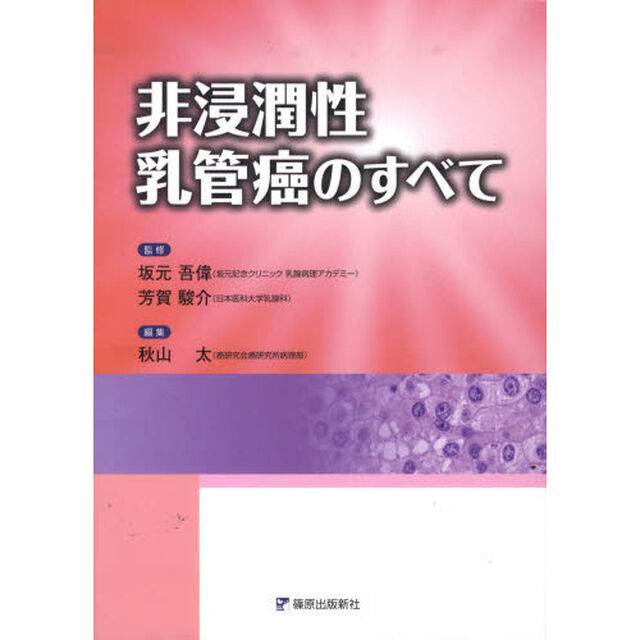 非浸潤性乳管癌のすべて