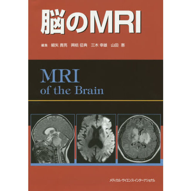 脳のＭＲＩ