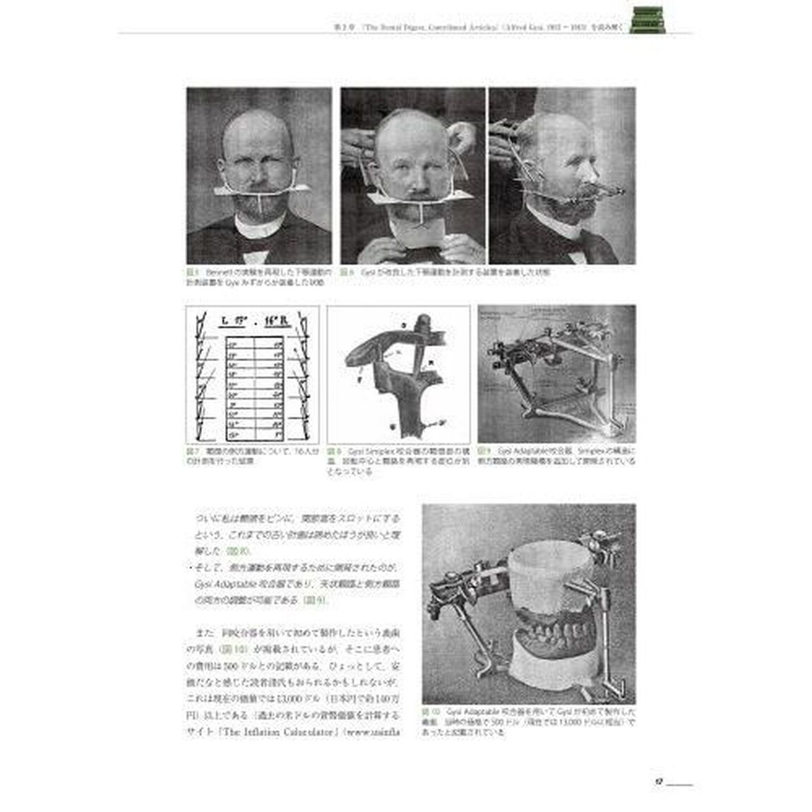 名著から学ぶ全部床義歯臨床　復古再生の治療コンセプト＆アプローチ