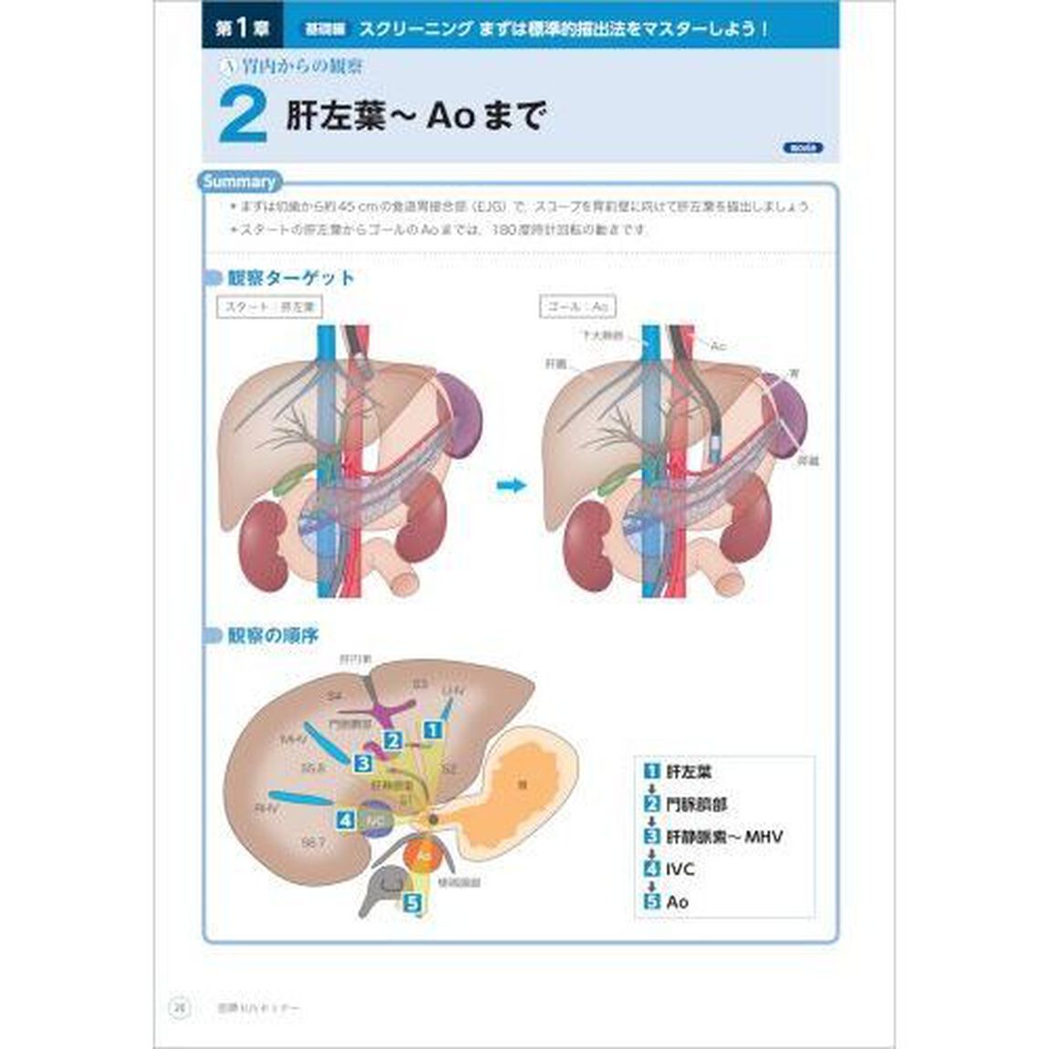 胆膵ＥＵＳセミナー　ＣＴ＋シェーマ＋動画と合わせてわかる手技の基本から治療まで