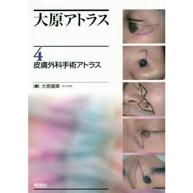 大原アトラス　４「皮膚外科手術アトラス」