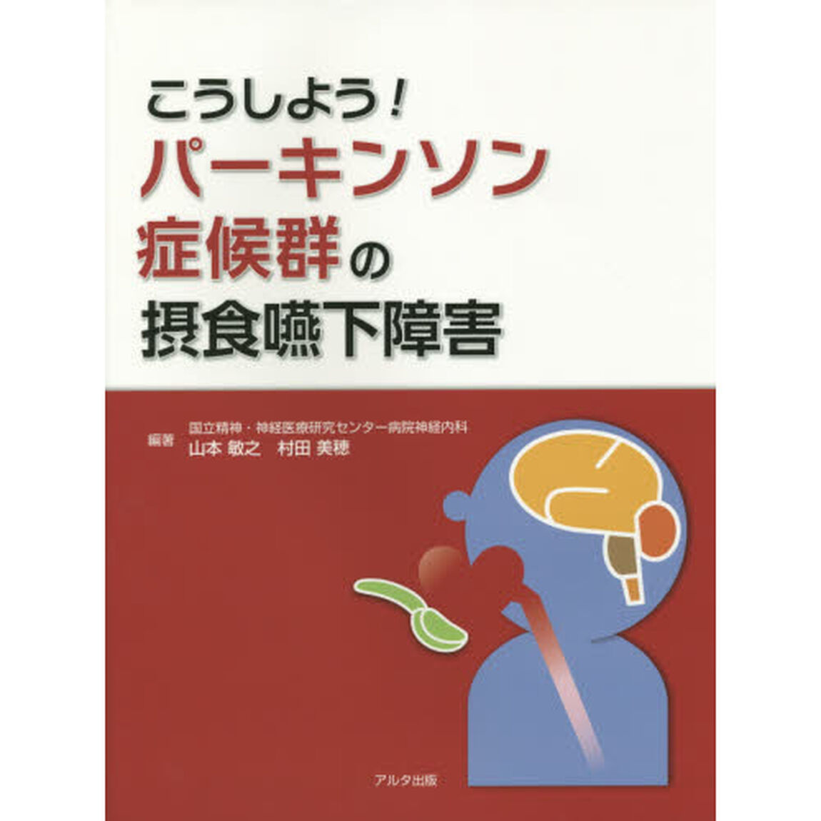 こうしよう！パーキンソン症候群の摂食嚥下障害