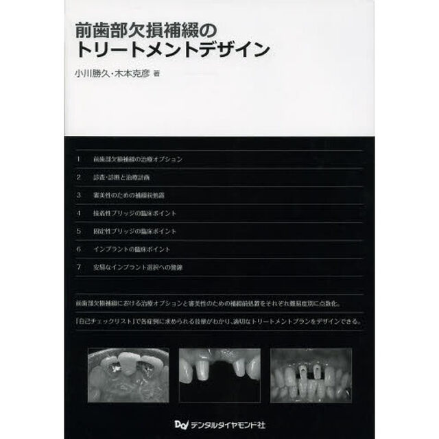 前歯部欠損補綴のトリートメントデザイン