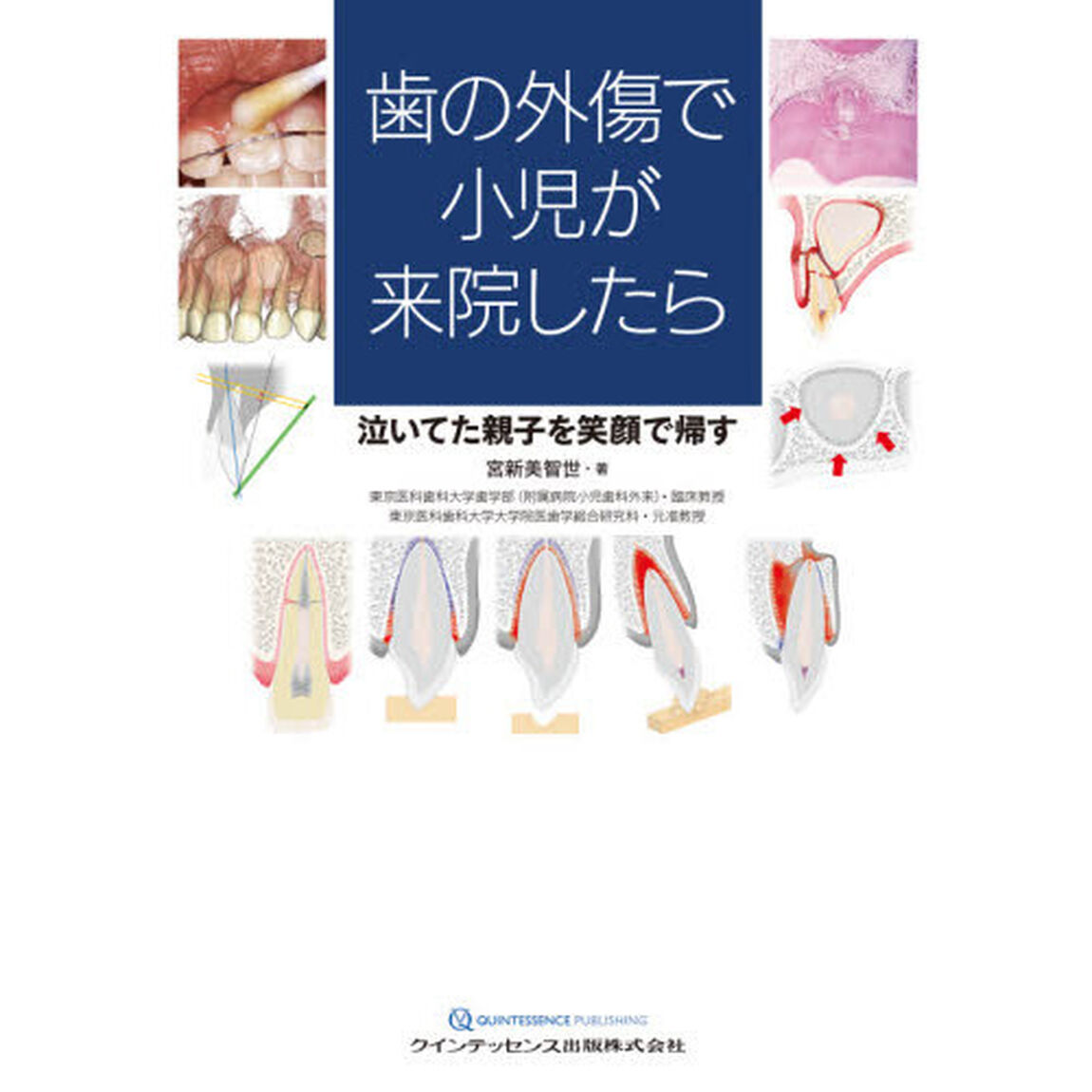 歯の外傷で小児が来院したら　泣いてた親子を笑顔で帰す