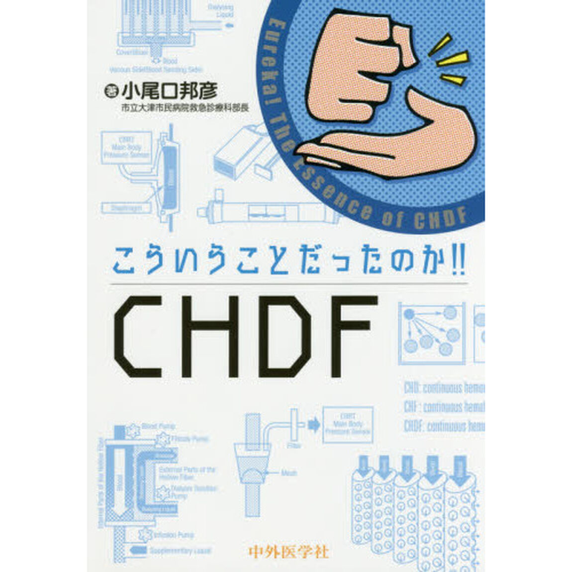 こういうことだったのか！！ＣＨＤＦ