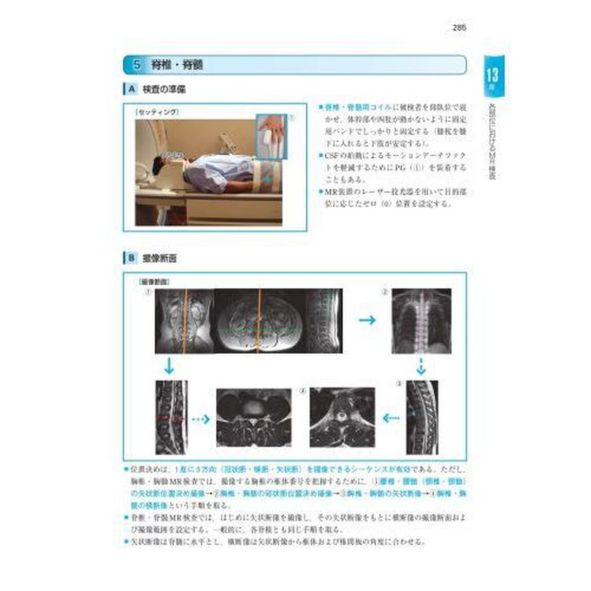 ＭＲ・超音波・眼底基礎知識図解ノート　図，表，画像が満載！要点がわかる！「第２版補訂版」