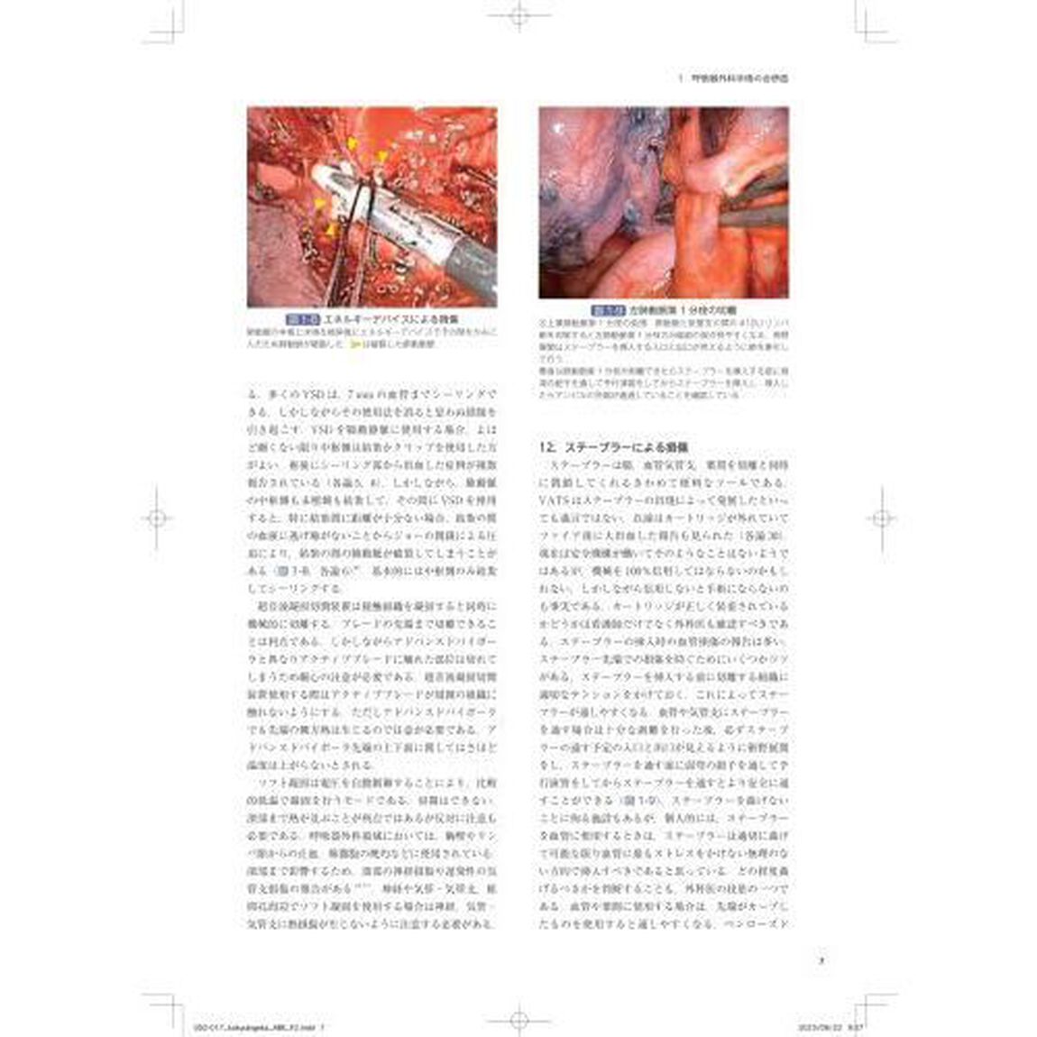 呼吸器外科　Ｍｏｒｂｉｄｉｔｙ　ａｎｄ　ｍｏｒｔａｌｉｔｙ　ｃｏｎｆｅｒｅｎｃｅ