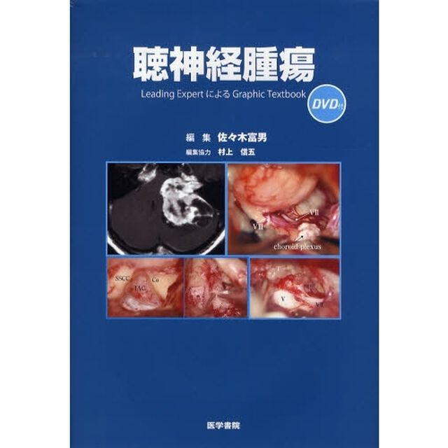 聴神経腫瘍　Ｌｅａｄｉｎｇ　ＥｘｐｅｒｔによるＧｒａｐｈｉｃ　Ｔｅｘｔｂｏｏｋ