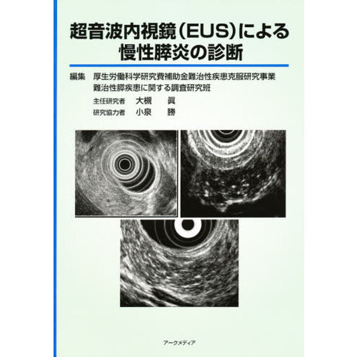 超音波内視鏡（ＥＵＳ）による慢性膵炎の診
