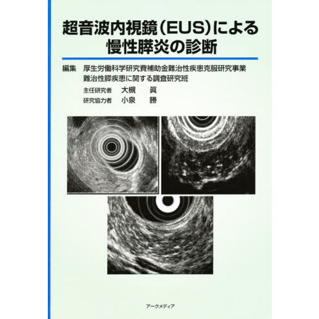 超音波内視鏡（ＥＵＳ）による慢性膵炎の診