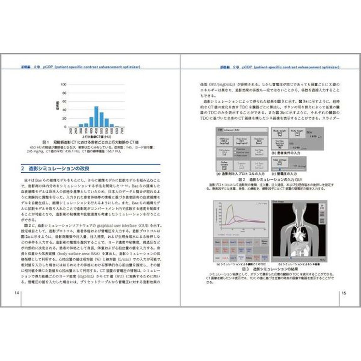 ｐＣＯＰの基礎と臨床応用　ＣＴにおける造影シミュレーション
