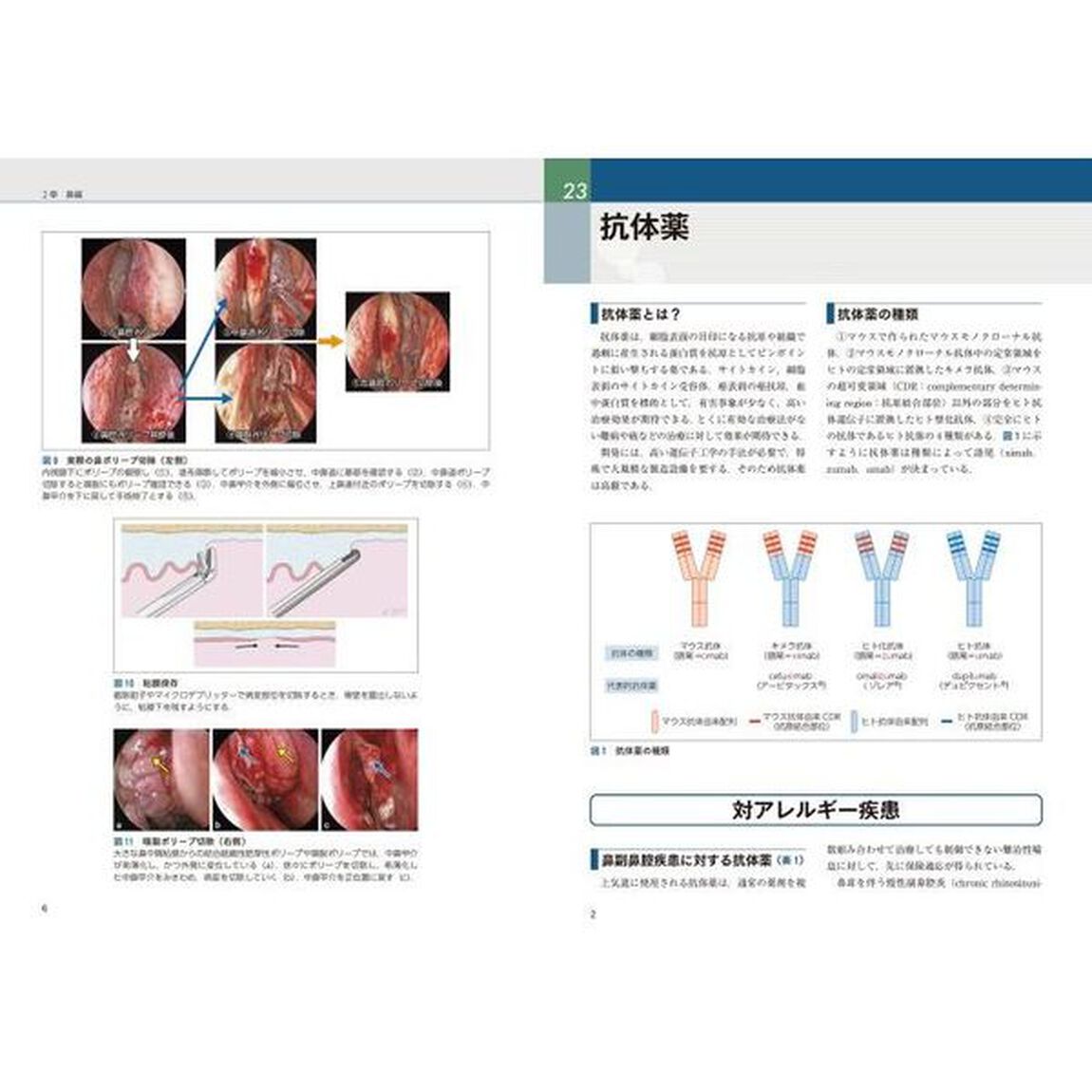 プラクティス耳鼻咽喉科の臨床　４「めまい診療ハンドブック　最新の検査・鑑別診断と治療」