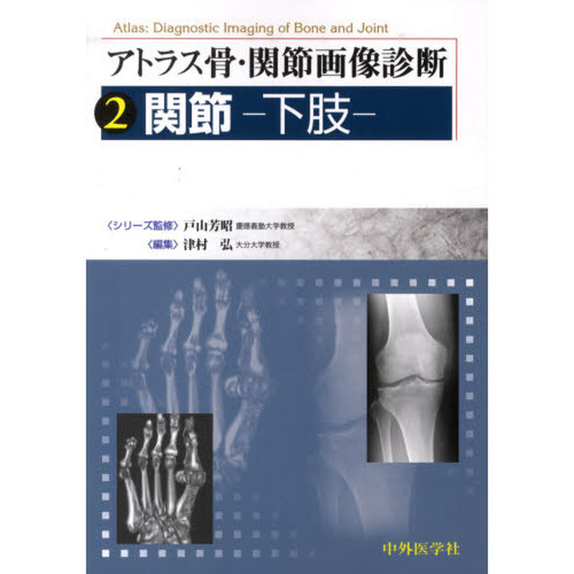 アトラス骨・関節画像診断　２「関節　下肢」