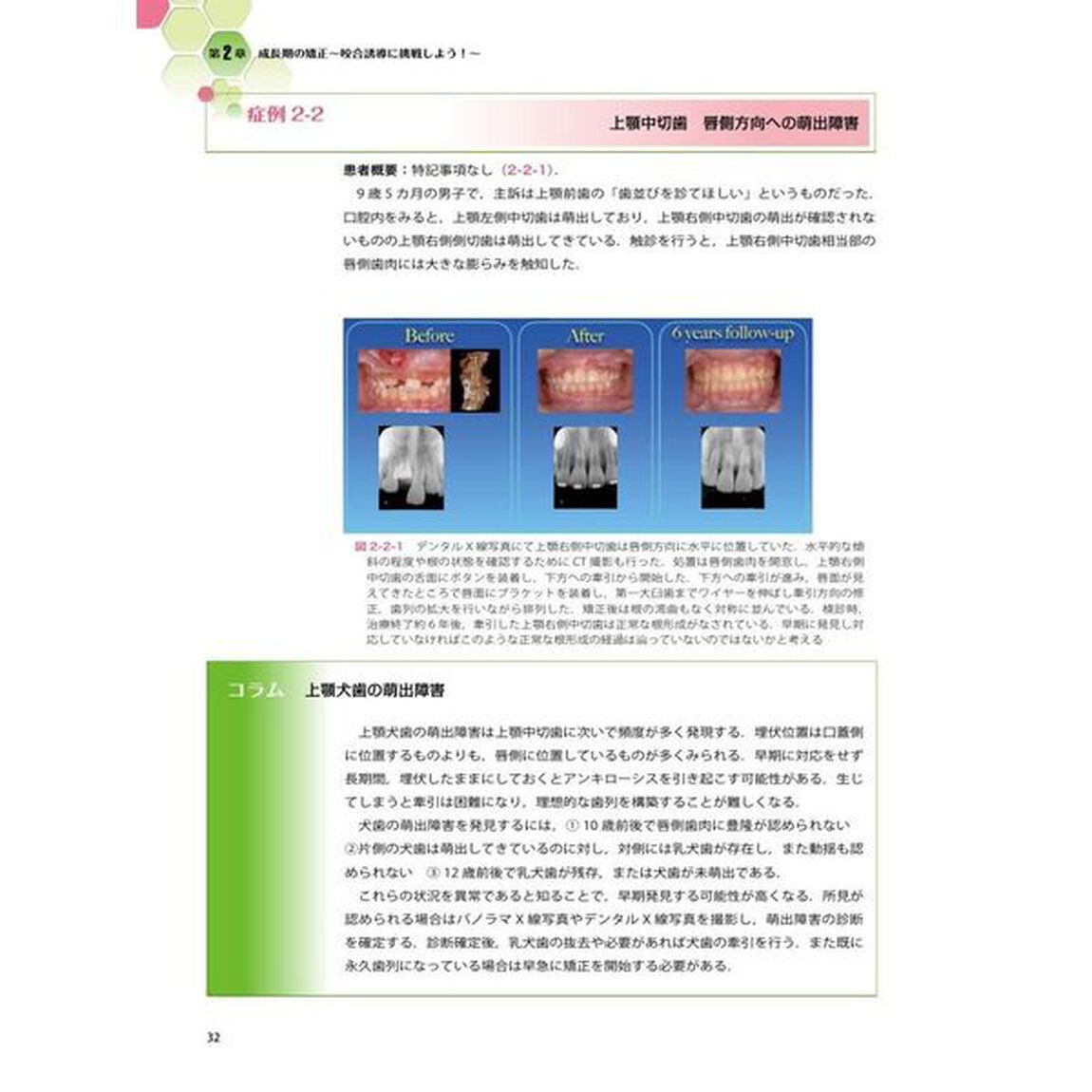 患者思いの歯科矯正治療　ＧＰが実践したい部分矯正・咬合誘導・全顎矯正