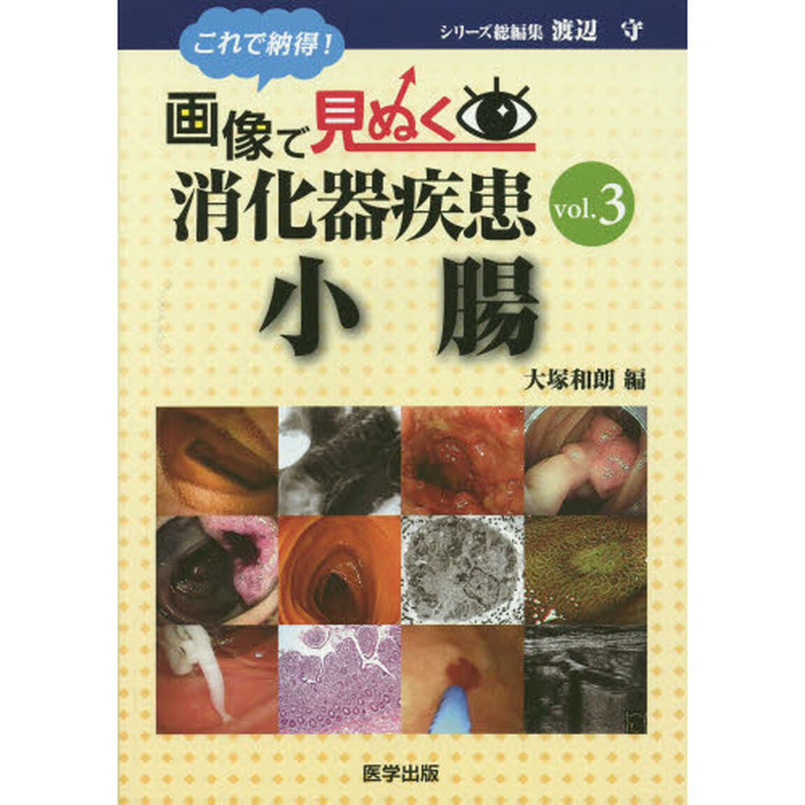 これで納得！画像で見ぬく消化器疾患　ｖｏｌ．３「小腸」